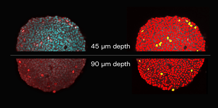 Spheroid imaging and analysis with TruAI. Left: Without TruAI. Right: With TruAI.