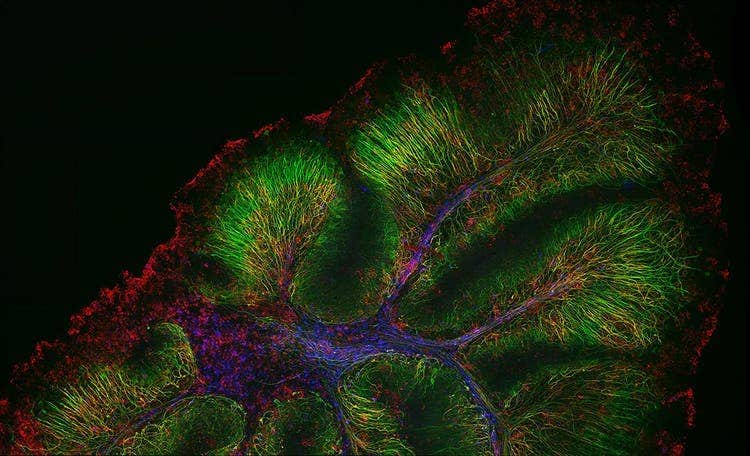 Zusammengefügtes Bild eines Gehirns bei 40-facher Vergrößerung