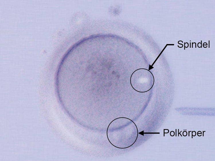 Spindel / Polkörper