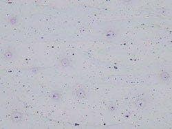 Aluminum alloy - Brightfield