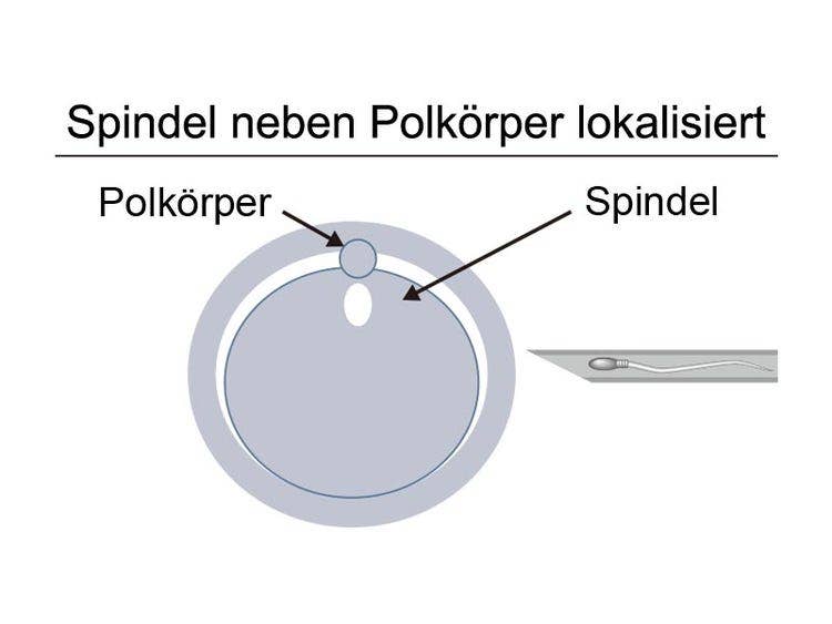 Spindel neben Polkörper lokalisiert