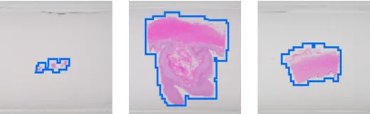 Erfassen Sie nur die Daten, die Sie benötige