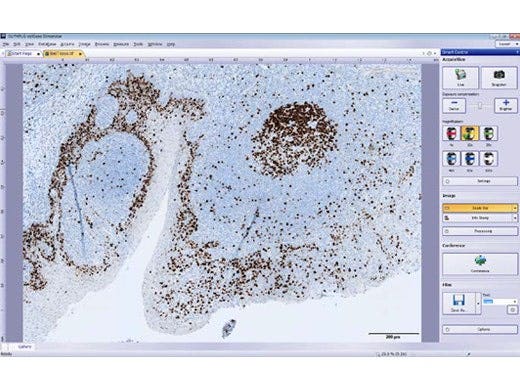 Einfache Aufnahme von Bildern in hoher Qualität mit der cellSens Software