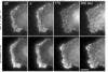 TIRF Imaging of Changes in Membrane Morphology and Molecular Dynamics