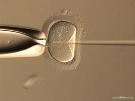 IVF/ICSI