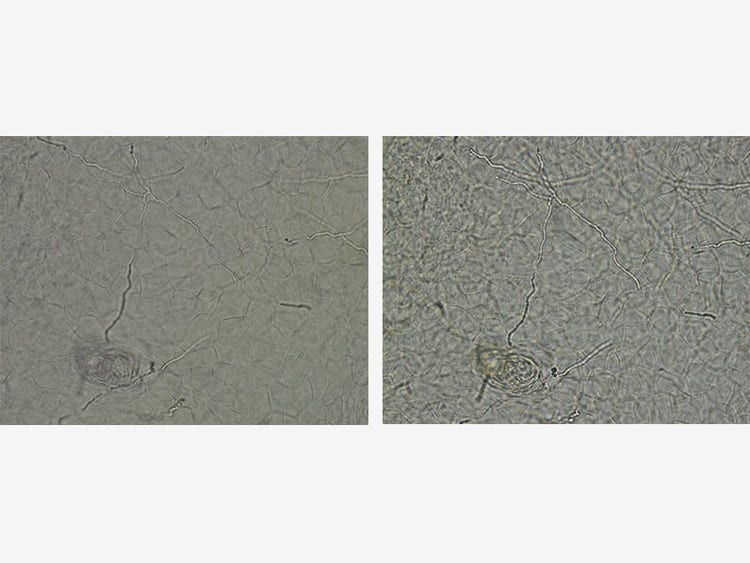 Links: CX41 mit geschlossener Aperturblende und Kondensor unten / Rechts: CX43 mit geschlossener Aperturblende / Probe: Trichophyton