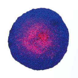 Fluorescent Image Analysis–Live Dead Cell Assay of Spheroids | Olympus LS