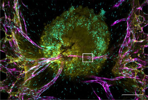 (a) Projection image of the tumor spheroid. Scale bar: 200 μm, objective： UPLSAPO10X2.