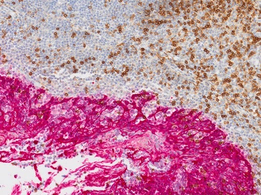 Cancer and Stem Cell Research