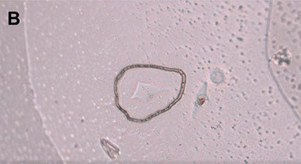 Figure 4: Workflow isolating a single living cell. B) The laser precisely cuts the membrane around the cell along the previously marked line.