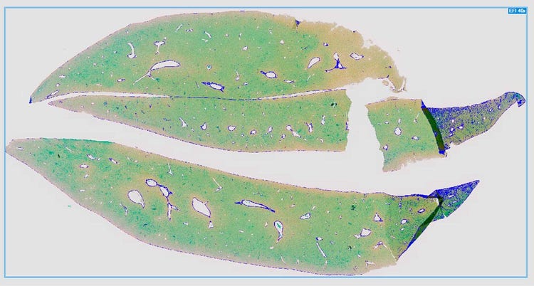 The analysis can be performed on the whole mouse liver section