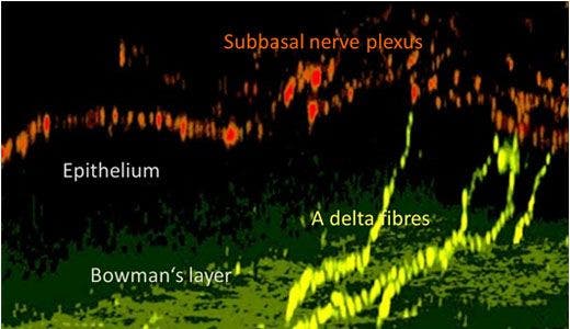 Figure 4: Nerve structure in the mouse cornea.