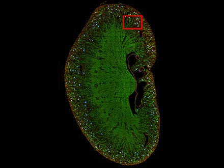 Figure 8: Prediction of glomeruli positions on a mouse kidney section using TruAI (blue).