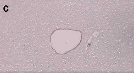 Figure 4: Workflow isolating a single living cell. C) The cell is lifted using the MMI isolation cap.