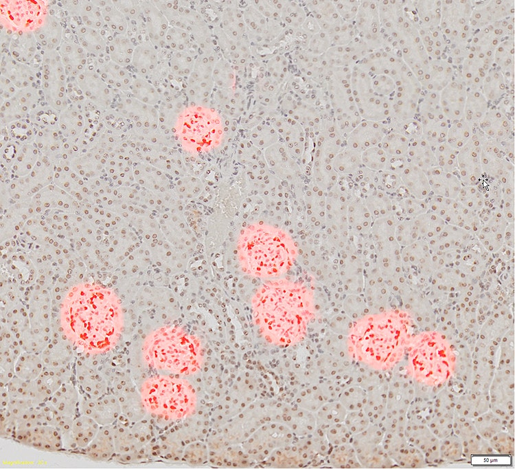 Glomeruli are detected and separated by the trained DNN