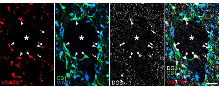 Quadruple immunofluorescence of brain tissue: Picture (1)