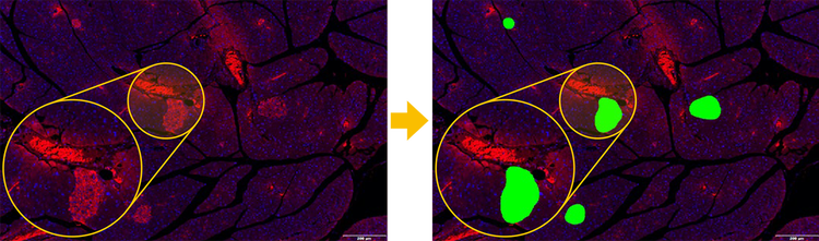 Probability map detection based on TruAI technology