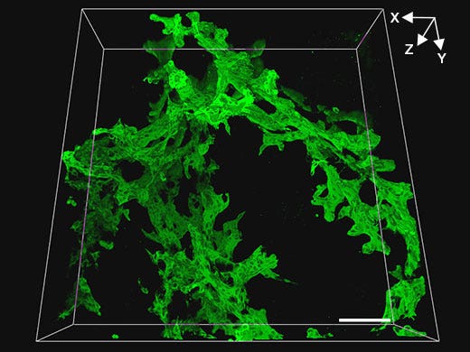 Three-Dimensional Observation of Biliary Tree Structure in Liver Injury Mice with 20x Objective UPLSAPO20X (NA0.75, WD0.6 mm)