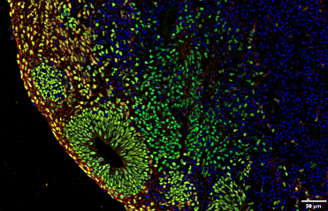 Speckle illumination acquisition image of an organoid sample acquired at 20X.
