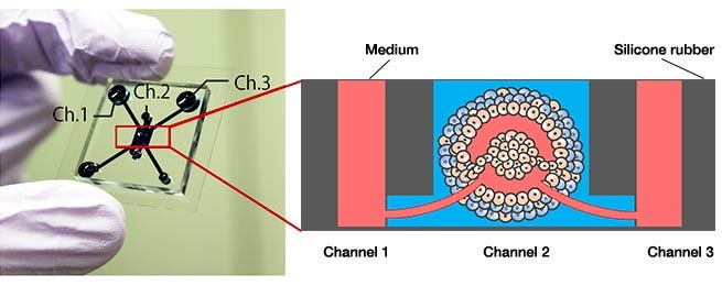 Figure 1. Microfluidic device and tumor model.