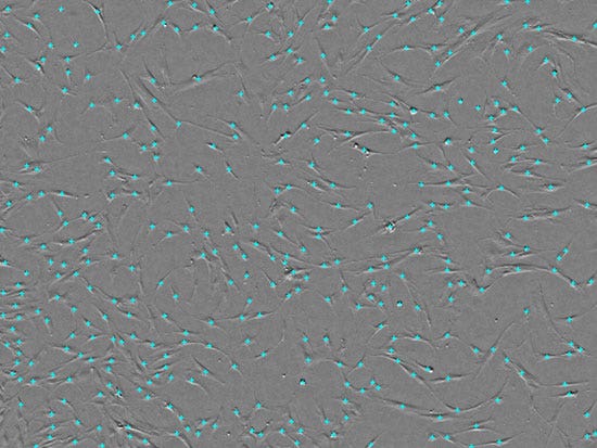 Fig.2 Acquiring MSC images and counting cells with CM20