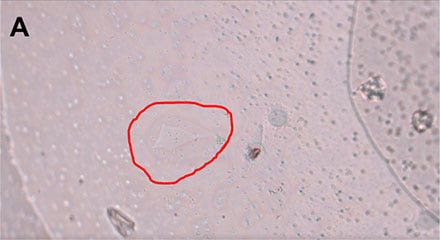 Figure 4: Workflow isolating a single living cell. A) A single cell is marked.