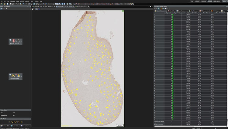 The detected glomeruli