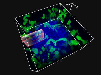 Fig. 2: NK cell line KHYG-1 (green) changing shape while attacking and killing HT-29 tumor cells labeled with cetuximab (blue). PI uptake (red) indicates cell death.