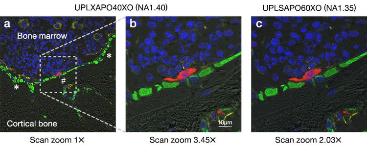 Figure 2: Fluorescent images of a mouse tibial cross-section