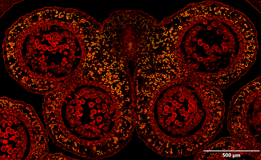Section of a SILA extended focus image (EFI) acquired at 20X magnification, showing a close-up view of a 12 µm lily flower bud.