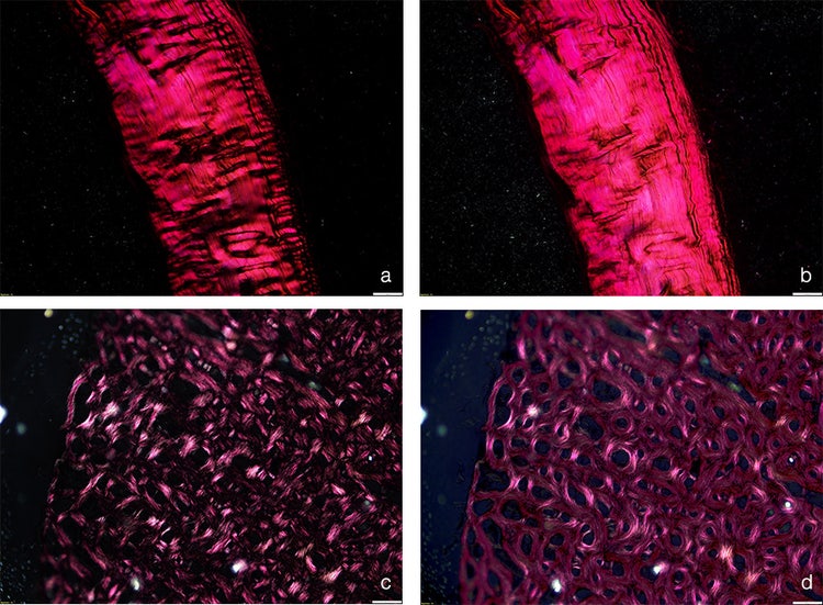 Images of connective tissue and bone under linear and circular polarized light