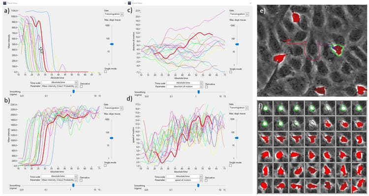 Individual cells were tracked and their parameters plotted over time to gain information about the dynamics of the transmigration cascade.