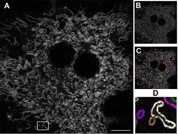 Figure 1: Mitochondrial network in a living mouse hepatocyte.