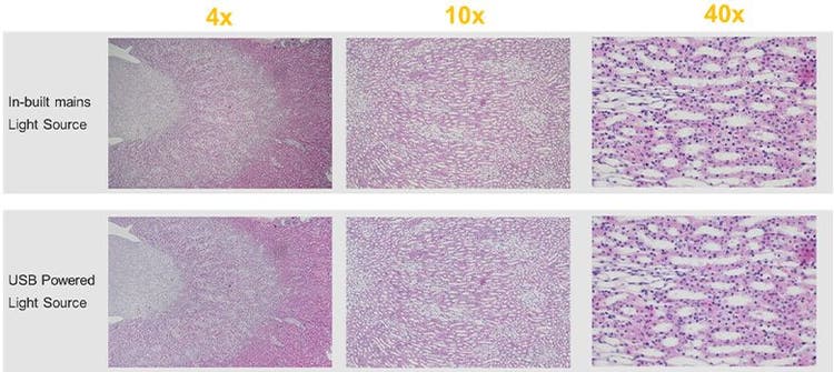 Mains powered light source versus USB battery-powered light source comparison of CX23 microscope images