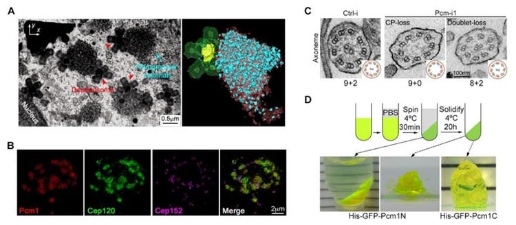 Figure 2. (A) Focused ion beam-scanning electron microscopy (FIB-SEM) showed the spatial distribution of fibrous particles and deuterosomes in multiciliated cells. (B) Fibrous particulate structure can enrich the structural protein Cep120 of the matrix. (C) Knocking down the protein level of PCM1 leads to obvious defects in the ultrastructure of the moving cilia. (D) PCM1 fragments have the property of phase separation.