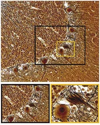 Figure 3: Comprehensive Analysis of Brain Tissue in a Single Image