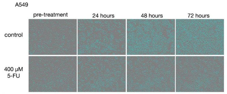 Figure 1. Images of A549 cells after treatments with 5-FU.