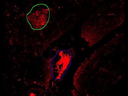 Pancreatic islet (green circle); blood cells (blue circle)