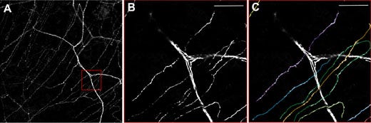 Figure 3: Neurones in the cornea of a thy1-YFP mouse.