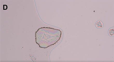 Figure 4: Workflow isolating a single living cell. D) The isolated cell can be inspected by focusing on the surface of the MMI isolation cap.