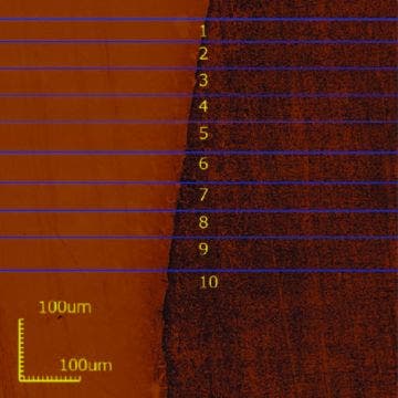 Figure 1: Profilometry analysis of eroded dental enamel by hydrochloric acid. Left side: corresponding control area. Right side: corresponding eroded area.