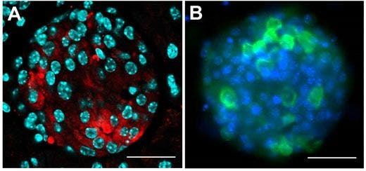 Figure 2: Investigating the pancreatic islet cells in mouse.