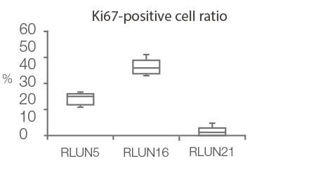 Ki67-positive cell ratio