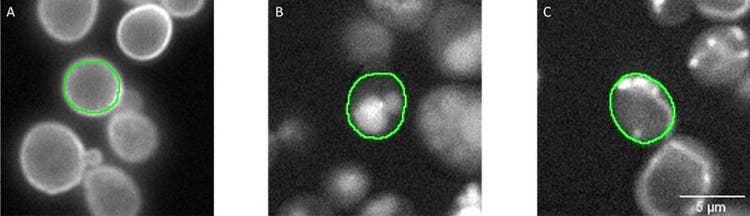 Figure 3: Segmentation masks (green) of individual cells segmented in the transmission channel (not shown). Fluorescent signals represent proteins localizing in A) the cell periphery (well 60, C12), B) the vacuole (well 266, L2), and C) mitochondria (well 147, G3). The ground truth annotations were assigned automatically in the scanR software by combining the segmentation mask, the fluorescence channel, and the well number.