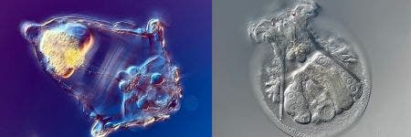 Synchaeta sp. and Testudinella patina rotifers under the microscope