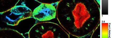 Single-molecule sensitivity in confocal microscopy