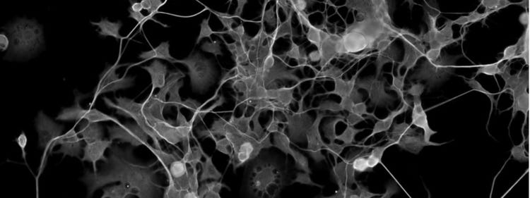 Electrophysiology image