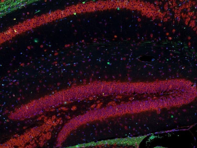 Fluorescence imaging of a mouse brain