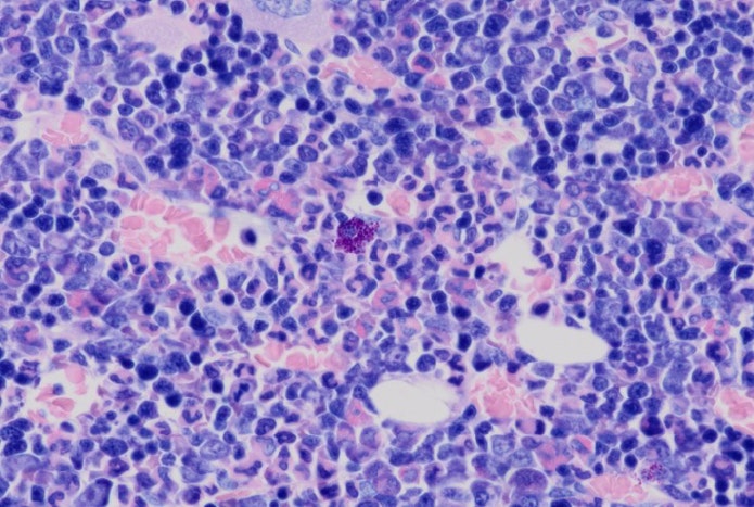 Microscope image of rat bone marrow captured using the DP23 camera.