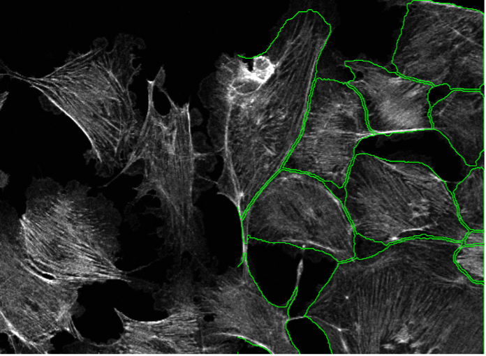 Deep learning image segmentation of BPAE cells